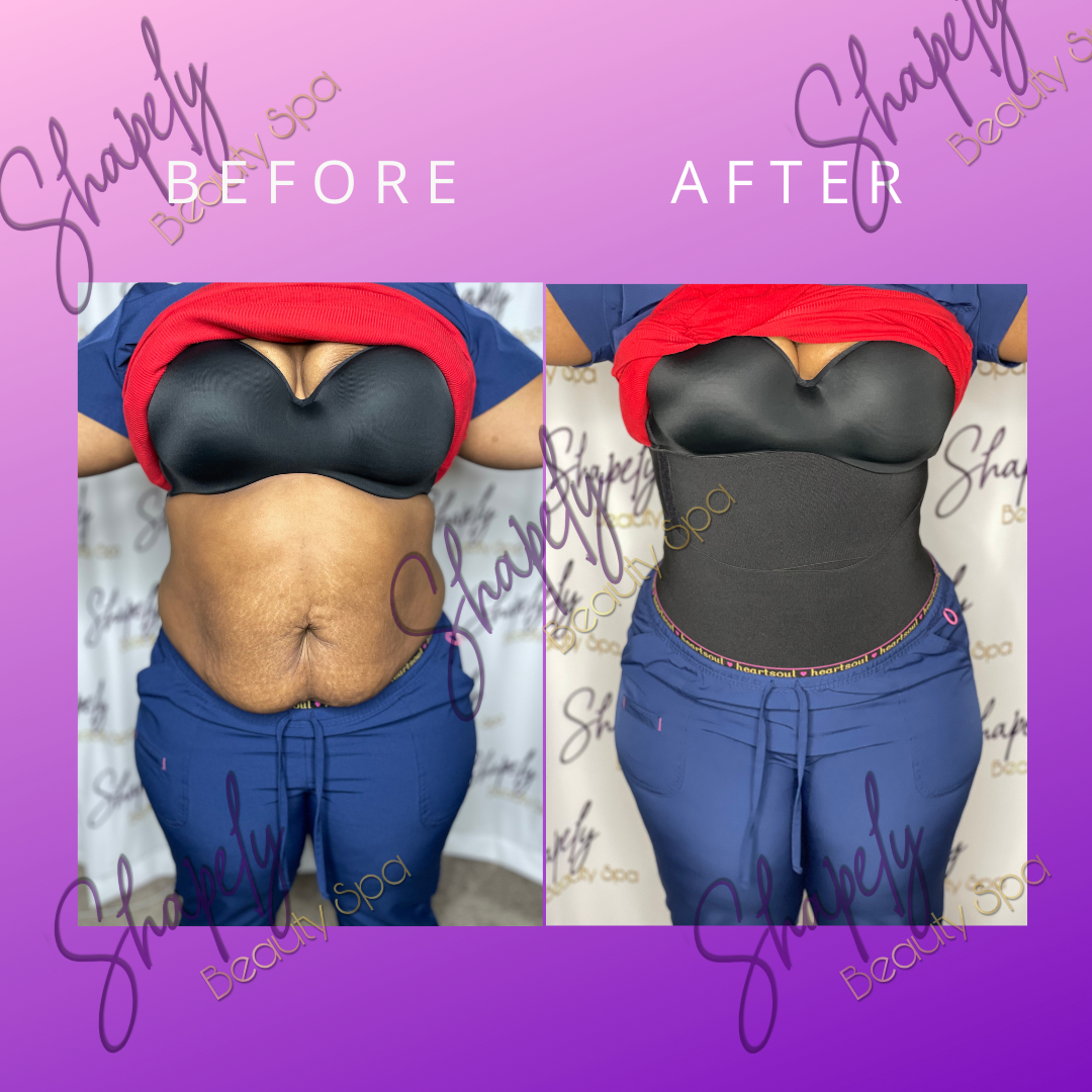 Snatch Me Contour Wrap