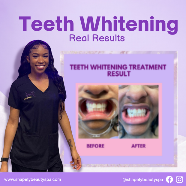 Teeth Whitening 101 Online